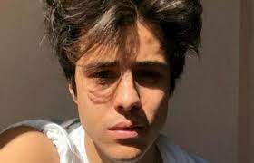 Michele merlo si è fatto conoscere riuscendo a ritagliarsi un posto nella rosa dei concorrenti in gara al serale dell'edizione 2017 di amici (faceva parte della squadra bianca. 958pu5ekmmdytm