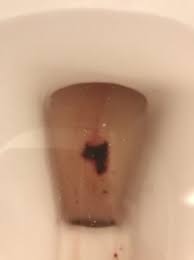 I carried it with me for days, bleeding in cars and on couches and while i made the kids lunch. Miscarriage At 6 Weeks Trigger Babycenter