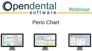 open dental webinar perio chart