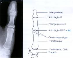 Resultado de imagem para rx com laudo membros