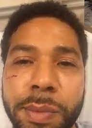 Friend Who Convinced Jussie Smollett To Go To Hospital On Night Of Racist Attack Speaks Out Daily Mail Online