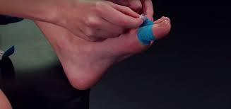 A sprain to the first metatarsophalangeal(mtp) joint , otherwise known as a 'turf toe' or 'death toe' , is a common injury in athletes in which the plantar capsule and the ligament of first metatarsophalangeal joint is damaged. Do You Know How To Relieve Your Turf Toe Pain