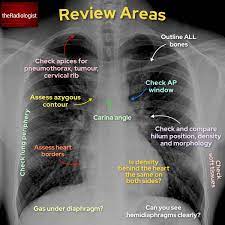 A collection of anatomy notes covering the key anatomy concepts that medical students need to learn. Theradiologist On Twitter Basics Chest X Ray Anatomy And Review Areas Foamrad Foamed