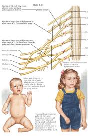 Check spelling or type a new query. Brachial Plexus And Or Cervical Nerve Root Injuries At Birth Pediagenosis