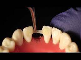 Pin On Dentistry