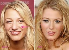 Virtual nose job surgery is a other game 2 play online at gahe.com. Rhinoplasty And Nose Job Android App Free Download In Apk
