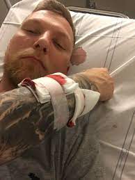 Kungentv asmon reacting poggers asmongold's twitch: Kungentv On Twitter I Usually Go To Bed At 23 Super Tired Gonna Do My Best To Sleep Even Though Ill Probably Fail My Pro Self Put On Bandage Or Whatever You