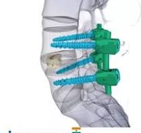 Mastering Back Stability: The Comprehensive Guide to ...