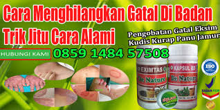 Kt bhgn melupuskan aset tu, kalau la tahun tu ada jual rumah ke, tanah ke, atau aset yg tertakluk di bawah akta cukai, pilihlah ya dan pilih sama ada dah melaporkan pelupusan pd lhdn atau tak. Cara Menghilangkan Gatal Di Badan Jitu Dan Cara Alami