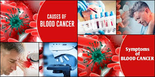 Click to call chat online now. What Is Blood Cancer Symptoms Causes Treatment 5 Key Questions