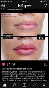 Pin By Arlene Kelleher On Lips In 2020 Dr Kevin Order Of The Day Lips