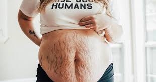 All women who might become pregnant should take a daily vitamin supplement containing folic acid. 18 Women Who Showed Their Bodies After Pregnancy And We Re Proud Of Them