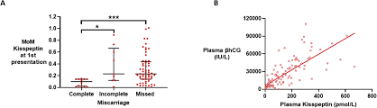 Oltre 400mila euro, spesi in due anni, tra il 2011 e il 2012. Performance Of Plasma Kisspeptin As A Biomarker For Miscarriage Improves With Gestational Age During The First Trimester Fertility And Sterility