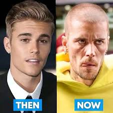 💥 Justin Bieber, what's wrong my Boy ?!? 😭