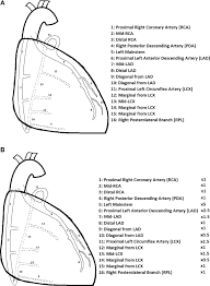 Arterial tree — in anatomy, arterial tree is used to refer to all arteries and/or the branching pattern of the arteries. Perioperative Factors Associated With Changes In Troponin T During Coronary Artery Bypass Grafting Journal Of Cardiothoracic And Vascular Anesthesia