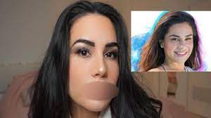 La jeune femme a confié sur snapchat son souhait de retrouver son visage d'avant Milla Jasmine Sa Derniere Operation De Chirurgie Esthetique Choque Ses Fans