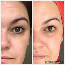 Templespa Skincare added a new photo.