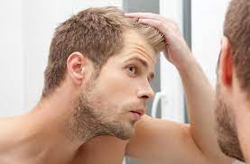 Factors such as stress, exposure to chemicals or uv rays, smoking and consuming alcohol can play a role in triggering or exacerbating the loss of hair (and can also affect recovery from hair restoration surgery). 6 Common Causes Of Hair Loss In Men Healthy Essentials