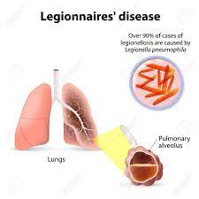 Vous avez des travaux à réaliser chez vous ? Legionarskrankheit Oder Legionellose Ist Legion Fieber Eine Form Der Atypischen Lungenentzundung Legionella Pneumophila Lizenzfrei Nutzbare Vektorgrafiken Clip Arts Illustrationen Image 45215439