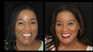 Dentist in Hollywood, FL