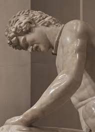 Dying Gaul