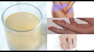 Learn how to cure penile yeast infection fast with home remedies and other effective methods. Vaginal Yeast Infection Surprising Cures That Work Fast