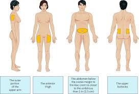 Image result for Subcutaneous Injection
