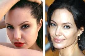 Angelina Jolie Plastic Surgery Has Angelina Had A Nose Job Plastic Surgery Celebrity Plastic Surgery Angelina Jolie Plastic Surgery