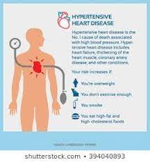 Vector Infographic Of Hypertensive Heart Disease Human Circulatory System Circulatory System Circulatory System For Kids
