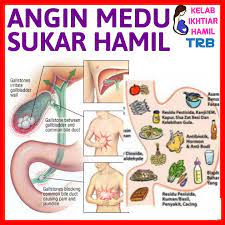 Masalah dengan rahim kehadiran polip dan fibroid di dalam rahim juga merupakan punca utama. Angin Medu Punca Sukar Hamil Kelab Ikhtiar Hamil Facebook