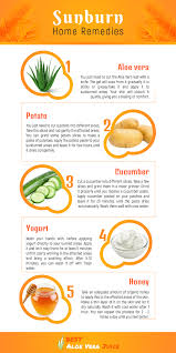 Top 5 Sunburn Home Remedies Home Remedies For Sunburn Natural Remedies For Sunburn Sunburn Remedies