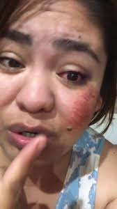 MIREN COMO TENGO MI CARA😭😰🥺#megolpee #lastimadura #hazmeviral #para...