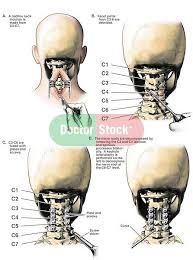 Pin On Spine Health