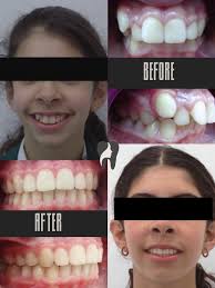 Dr Naveed Patel Dental