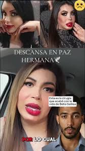 Paralisis Facial Vanessa 4k