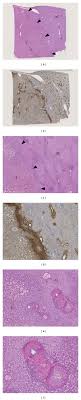 Of op zoek naar betrouwbare sneltesten? The Transitional Area Of Ihca And Adjacent Liver A C He Stained Download Scientific Diagram