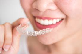 Each aligner moves the teeth a small amount until they have straightened to the final position. Braces Vs Invisalign Plus What Is The Average Cost Of Invisalign