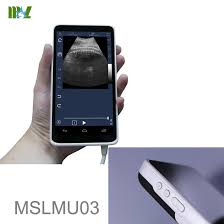 Available to us military, police officers during the ultrasound session, we will be conducting a limited diagnostic scan to confirm. Mobile Sonogram Usg Machine Scan Price Mslmu03 For Sale
