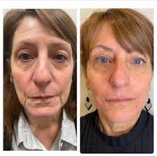 SkinAFX (@skinafx) • Instagram photos and videos