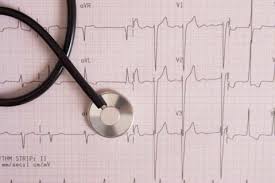 Congestive Heart Failure Causes Symptoms Stages Caredash