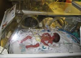 Das Zwillingswunder Alexander Und Nicolas In Bildern Babycenter