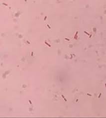 Image result for Striga baumannii