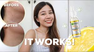 Content updated daily for best supplements for skin. Garnier Vitamin C Serum Review 3 Days 7 Days Results Philippines Skin Care Youtube