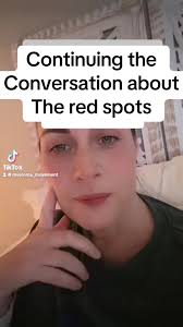 #health #cancer #myeloma #fy #viral #signs #fypシ #red #spots #skin #blood  #bloodcancer #fypシ゚viral #multiplemyeloma #leukemia