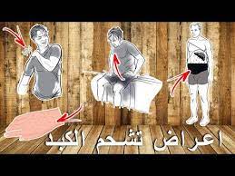 تشحم الكبد أعراض ودرجات تشحم دهون الكبد والوقاية والعلاج وأقوى 5 طرق لعكس تشحم الكبد د فارس عرب youtube character disney characters islam hadith