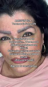 Espinas En La Piel Extraccion