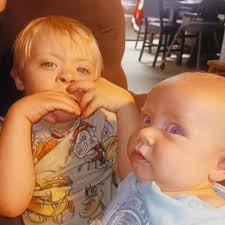 Down Syndrome Child Meets Santa