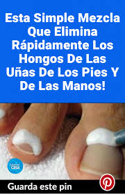 Esta Simple Mezcla Que Elimina Rapidamente Los Hongos De Las Unas De Los Pies Y De Las Manos Hongos Unas Pies Eliminar Hongos De Las Unas Remedio Para Hongos