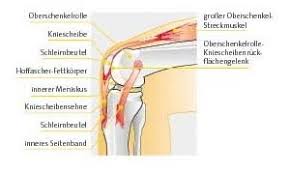 In 50 % der fälle den meniskus. Meniskusverletzung Dr Med Burkhard M Delsmann Facharzt Fur Orthopadie Sportmedizin Chirotherapie Akupunktur