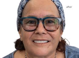 Dental Implants in Lemont, IL